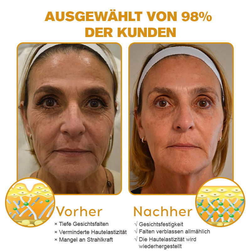 đ¨ââď¸Hergestellt und versendet aus Deutschlandâ
Furzero⢠Botox Bienenvenom Faltenentfernungscreme -Letzter Tag der Aktion: 70 % Rabatt