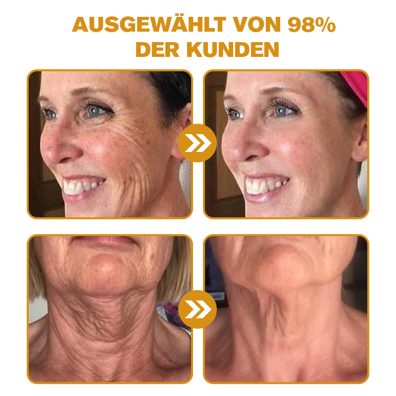 đ¨ââď¸Hergestellt und versendet aus Deutschlandâ
Furzero⢠Botox Bienenvenom Faltenentfernungscreme -Letzter Tag der Aktion: 70 % Rabatt