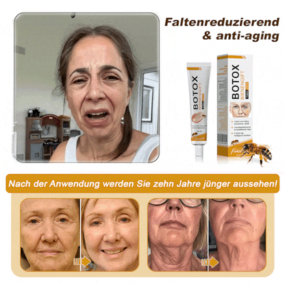 👨‍⚕️Hergestellt und versendet aus Deutschland✅ Furzero™ Botox Bienenvenom Faltenentfernungscreme -Letzter Tag der Aktion: 70 % Rabatt